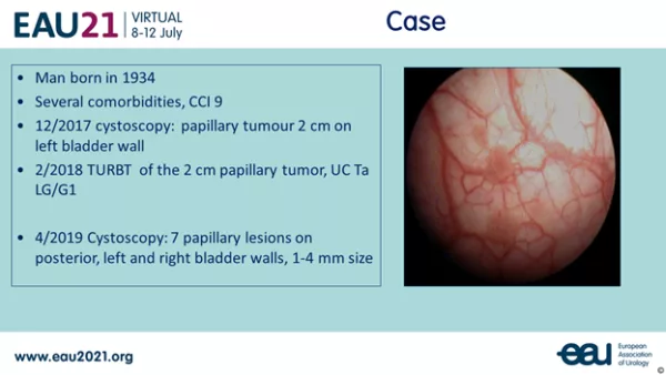 A PowerPoint slide with bullet points of the description of the patient in a patient case