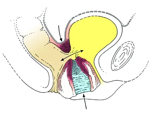 illustration of female urinary tract