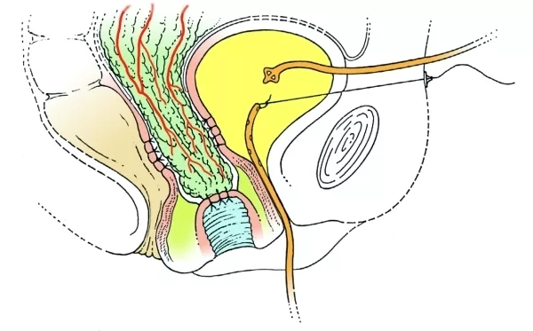 illustration of female urinary tract